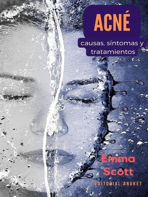 cover image of Acné